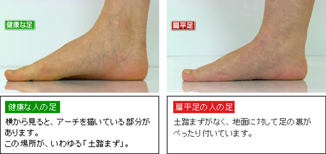 野球に必要な足趾トレーニング チェック Med野球 野球のトレーニングと治療についてー 野球に必要な足趾トレーニング チェック Med野球 野球のトレーニングと治療についてー