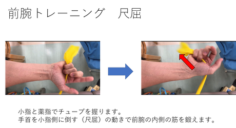 前腕尺屈