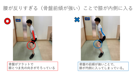 腰が反った位置でのスクワット 横から