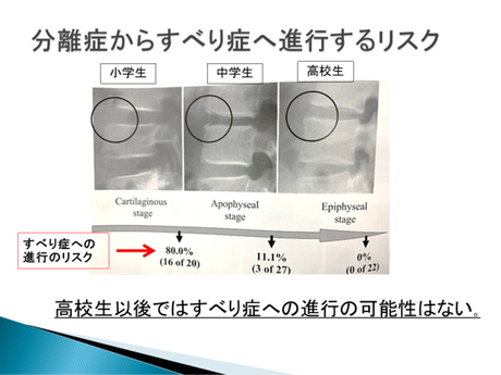 すべり症へのリスク