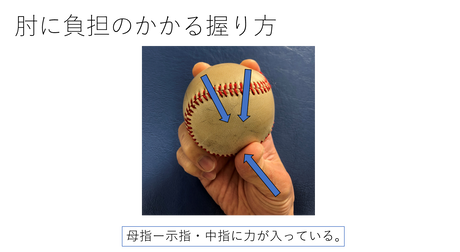負担のかかる握り方