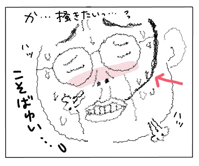 かゆい5