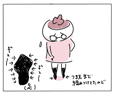 外反母趾6