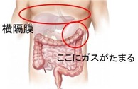 ガスが溜まる 画像1