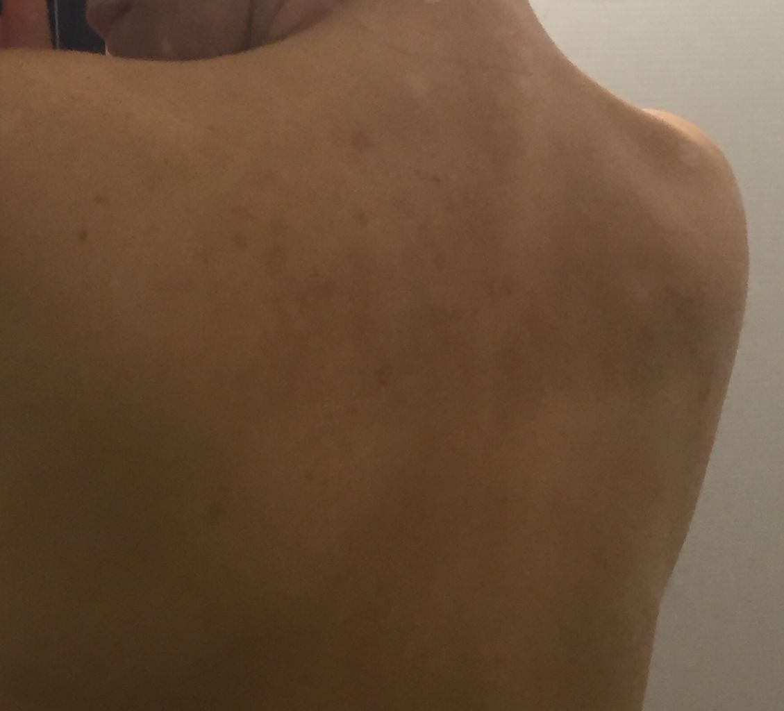 背中美人を目指して 三十路女の酒と食と旅