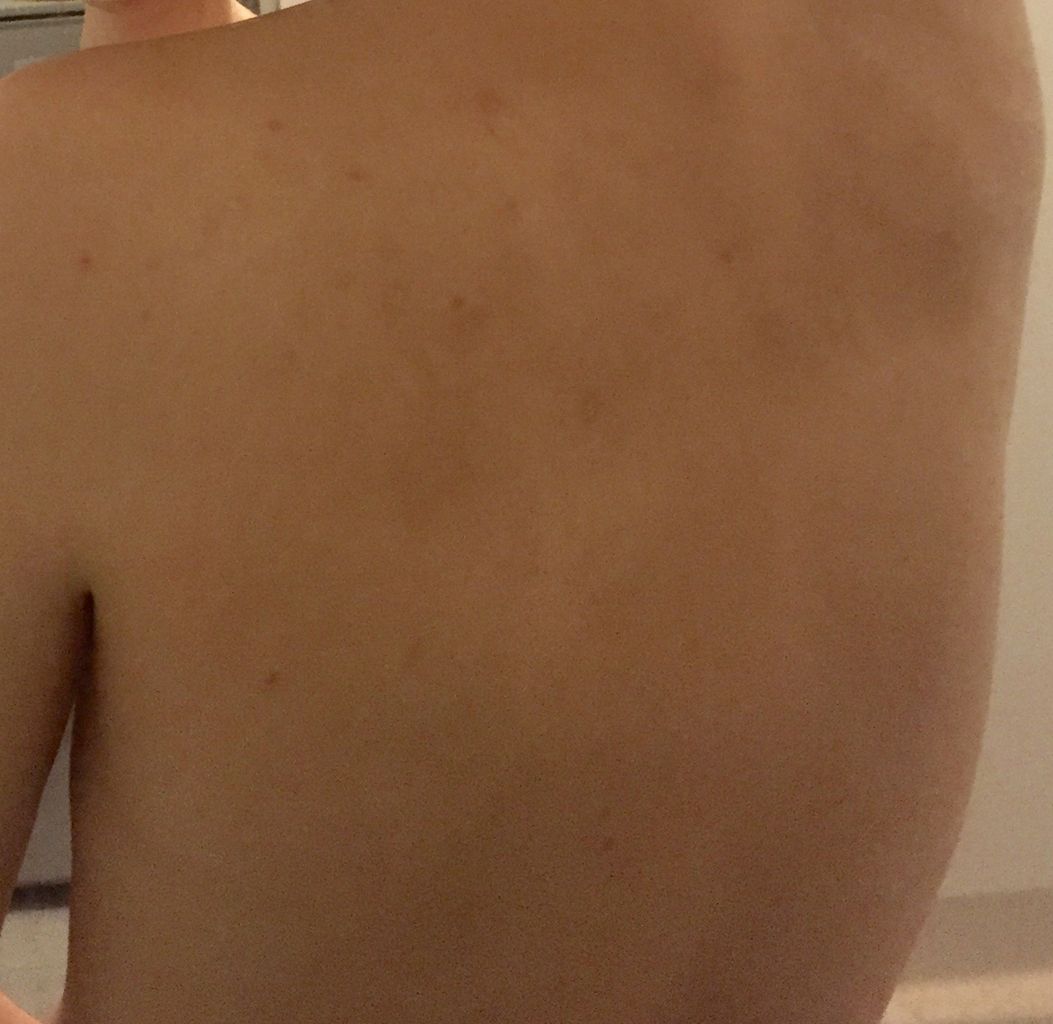 背中美人を目指して 三十路女の酒と食と旅