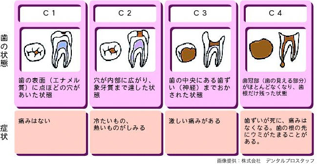 歯医者さんが歯科検診で早口で言う 謎の記号 の意味を調べてみた 花柄シュリケンblog