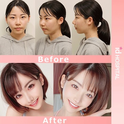 深田えいみ整形前5