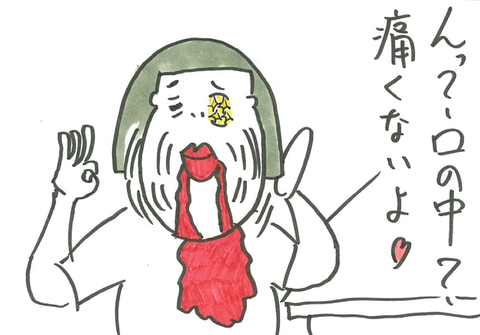 35