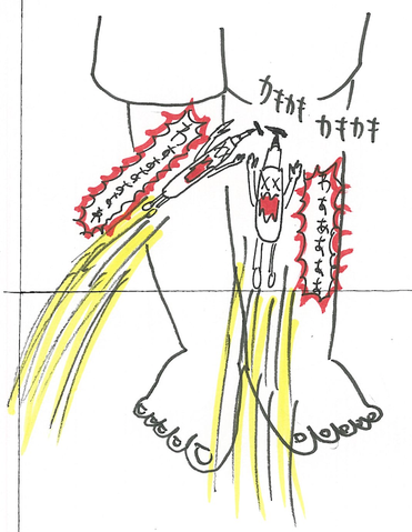 49