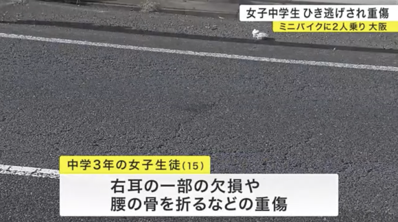 中学3年の男女2人が乗っていた原付バイクに車が追突、女子中学生が耳の一部欠損する重傷