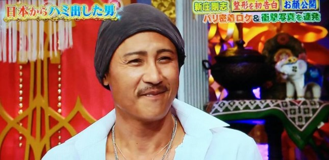 新庄剛志さん 整形した顔を披露ｗ Baseballlog