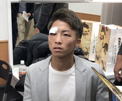 井上尚弥 目と鼻を骨折していた Baseballlog