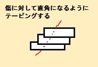 キャプチャ