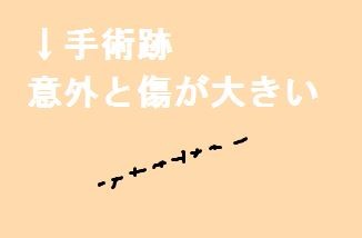 キャプチャ