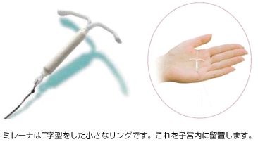 キャプチャ