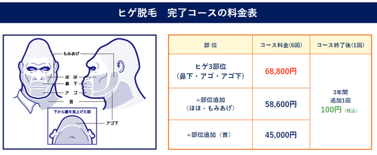 キャプチャ