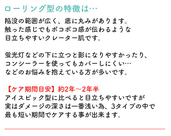 ローリング型