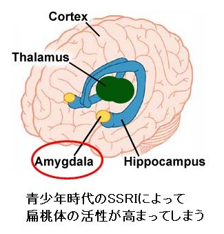 child neurolepica-3-12