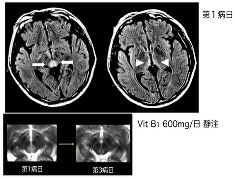 WE-MRI
