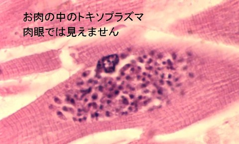 肉の中のトキソプラズマ