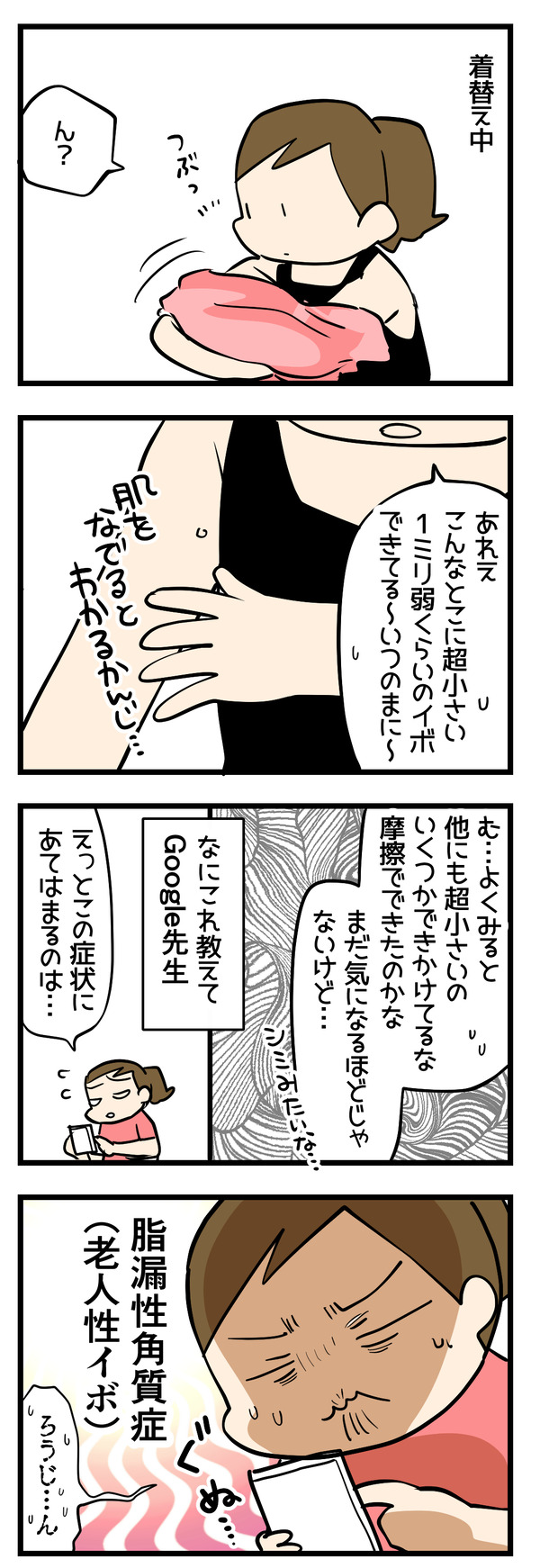 老人性イボ