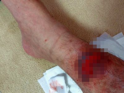 エイ被害経過 13w5d Bglビッグガーデンルアーズの最強理論 エイ被害経過 13w5d Bglビッグガーデンルアーズの最強理論