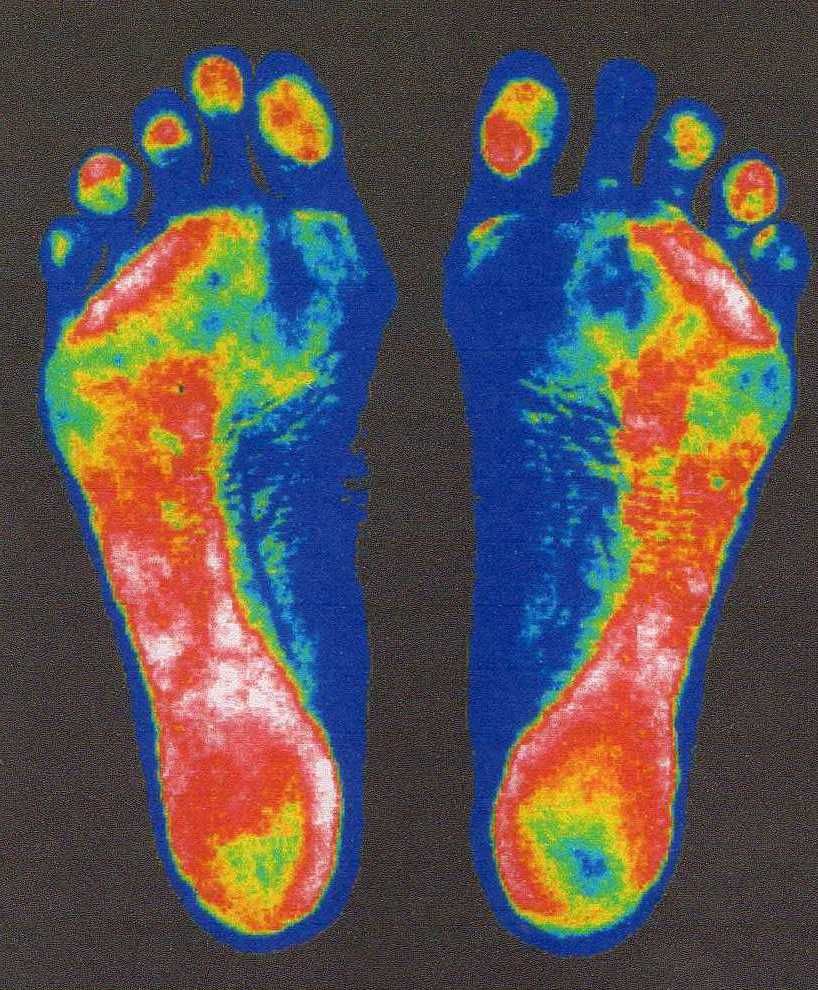 足指の付け根がピリピリする ランニング障害 岡山のo脚 骨盤矯正