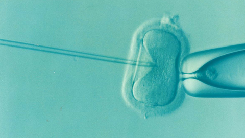 ivf-1514174_1280