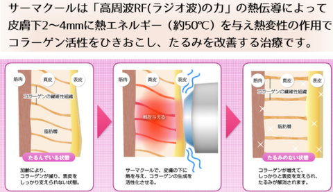 SnapCrab_NoName_2021-2-7_23-5-47_No-00