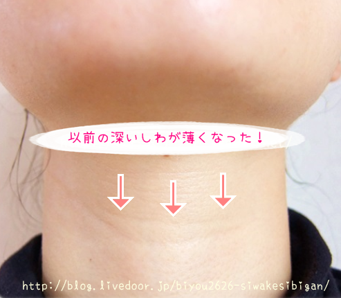 しわ取り対策美顔器 ララルーチェ 杉本彩愛用 でこじわ 首しわ ほうれい線 目の下しわに効く シワが消える杉本彩美顔器ララルーチュ しわ取り対策美顔器 ララルーチェ 杉本彩愛用 でこじわ 首しわ ほうれい線 目の下しわに効く シワが消える杉本彩美顔器ララルーチュ