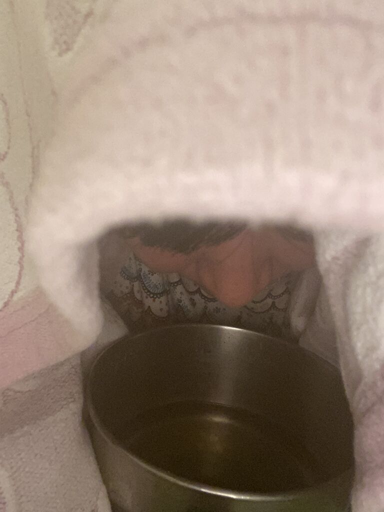 花粉症 一発で治ったアーユルヴェーダ治療 Bliss Life By Dr Rika