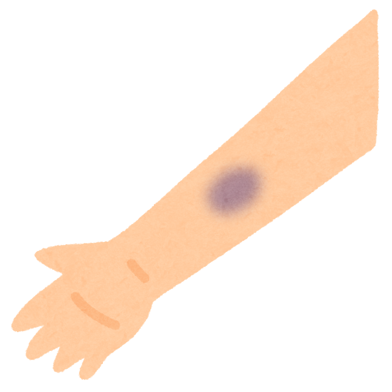 body_kega_aoaza_naisyukketsu