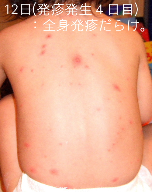 あぁ 水ぼうそう Vidro ビイドロ