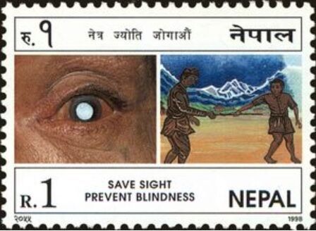 白内障.ネパール.1998
