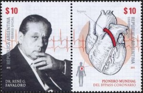 心臓バイパス.アルゼンチン.2015