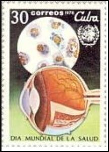 クラミジア.キューバ