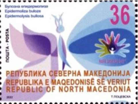 表皮水疱症.北マケドニア.2022