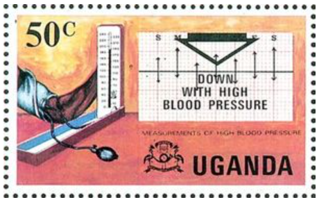 高血圧.ウガンダ.1978
