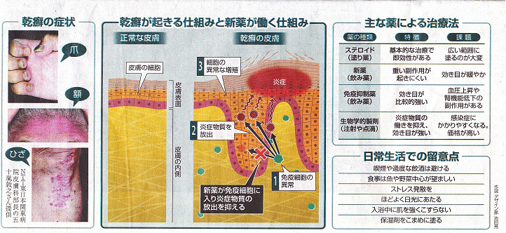 なかなか治らないチャドクガ皮膚炎 乾癬 かんせん 坊ちゃん葉山アーカイブス