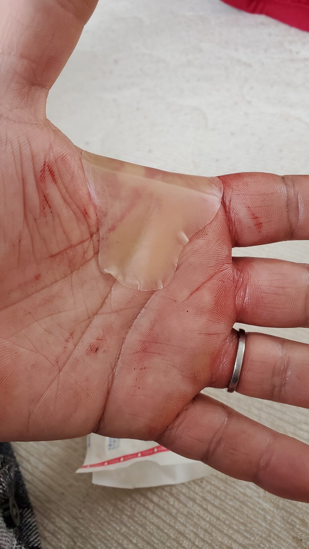 ノコギリで手を切っちゃう 庭池日記