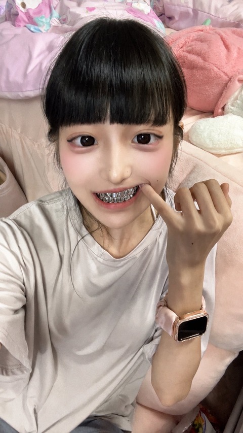 【画像】歯を治療した女、見た目がラッパーみたいになる