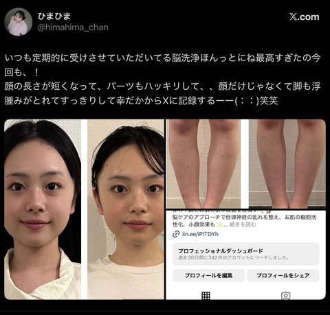 【画像】JK「脳洗浄ほんっとにね最高！顔が短くなって、すべてがスッキリするの🧠✨」