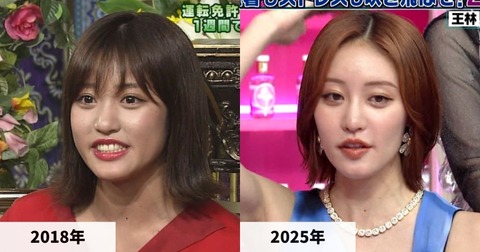 王林さん、顔が変わった？とネットで話題になる。