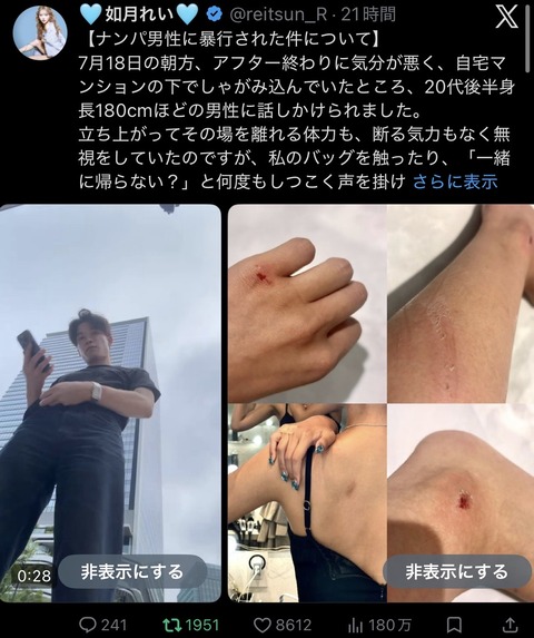 【動画】暑さでぐったり座り込んでいる女の子にナンパしながら盗撮。女の子が撮り返すと暴行。