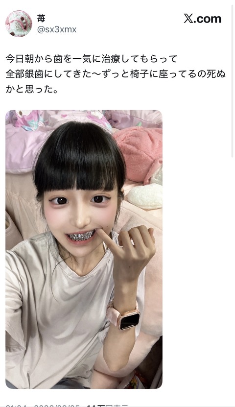 【画像】歯を治療した女、見た目がラッパーみたいになる
