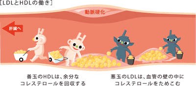 dys_image02
