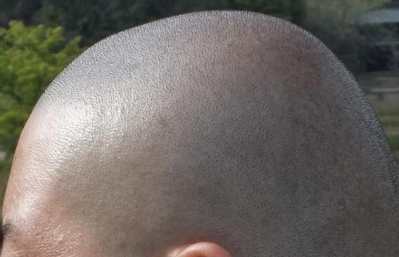 ジャカルタのマラソン 坊主男 スーパー坊主探偵団