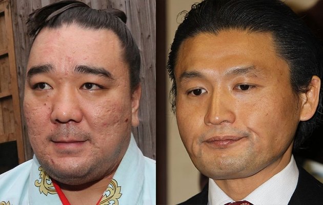 日馬富士、書類送検ｗｗｗｗｗｗｗｗｗｗｗｗ