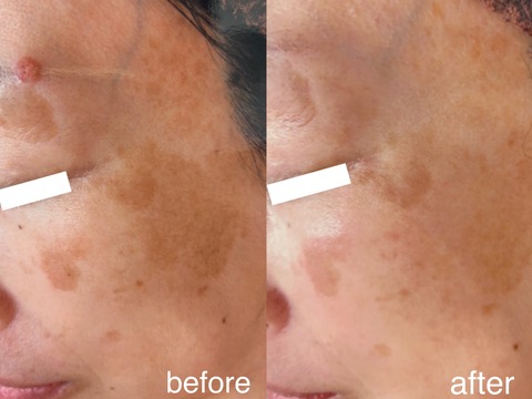 3F5F325C-FD81-4111-8281-BD4876E340D6